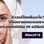 สิวฮอร์โมนคืออะไร? วิธีรักษาแบบธรรมชาติ พร้อมแชร์พิกัด 10 คลินิกรักษาสิว