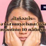 ฝ้าคืออะไร เกิดจากสาเหตุอะไรและวิธีรักษา พร้อมบอกพิกัด 10 คลินิกรักษาฝ้า