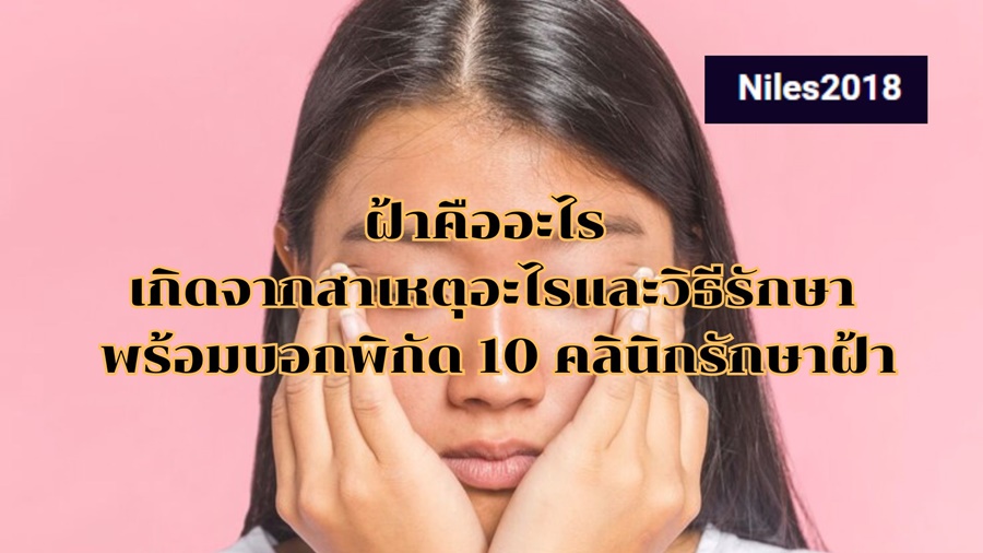 ฝ้าคืออะไร เกิดจากสาเหตุอะไรและวิธีรักษา พร้อมบอกพิกัด 10 คลินิกรักษาฝ้า