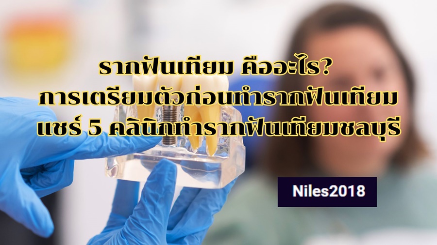 รากฟันเทียม คืออะไร? การเตรียมตัวก่อนทำรากฟันเทียม แชร์ 5 คลินิกทำรากฟันเทียมชลบุรี